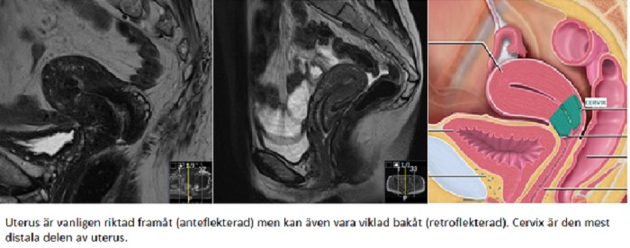 Cervix anatomi variant